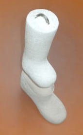 Obrzek -Cast of leg with severe deformity 